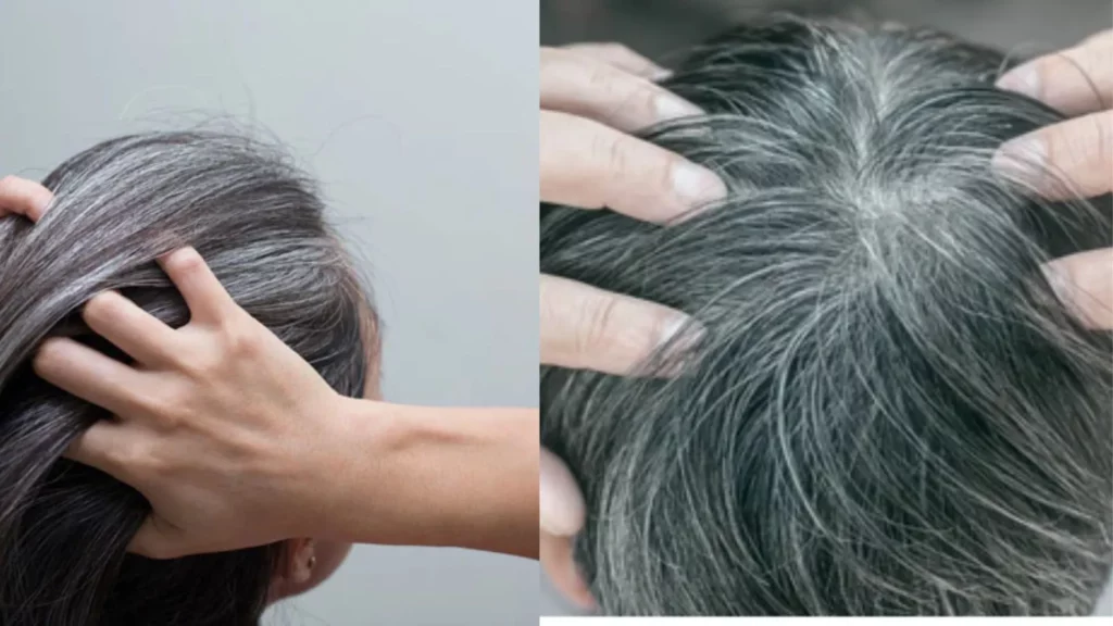 tips for grey hairs