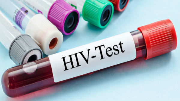 HIV Test